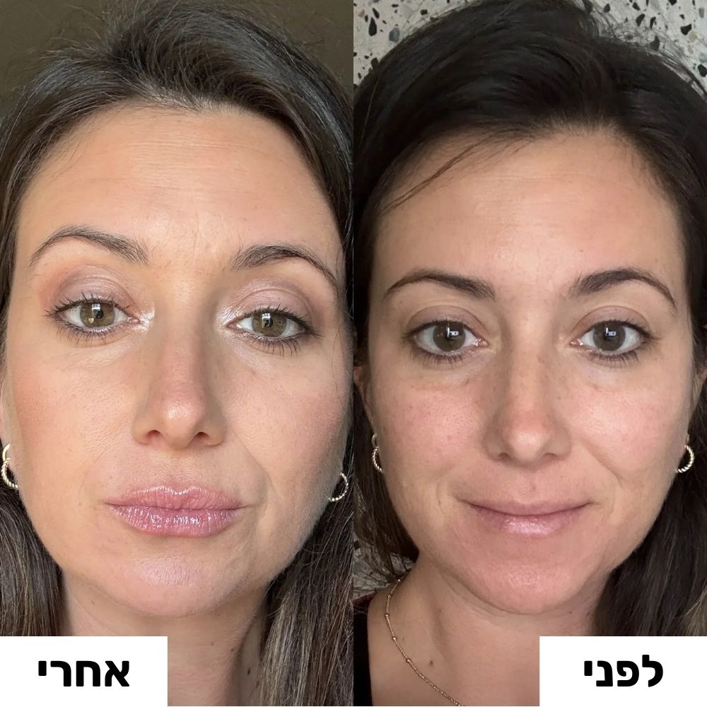 ליפס הקסם